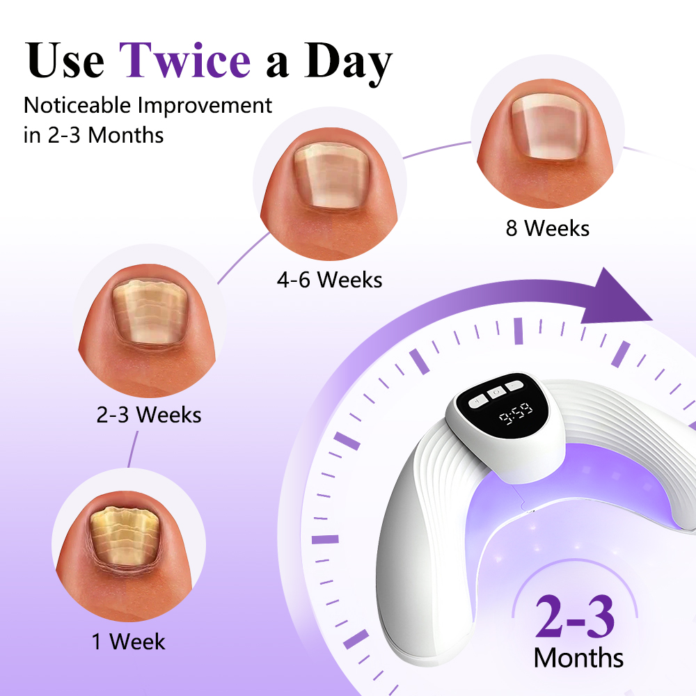 2-in-1 Nail Fungus Laser Devic - Industrial Laser Removal recension och pris
